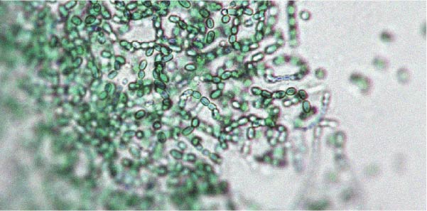 Il existe une relation entre le microbiote intestinal et l’activité physique