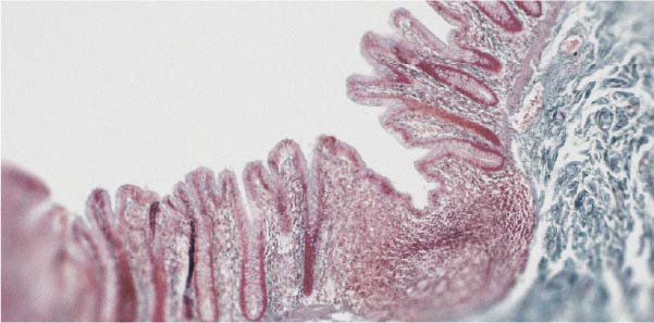 Le lien entre la glutamine et la permeabilite intestinale