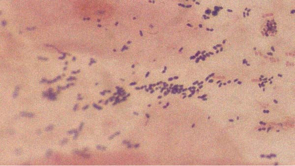 Tout ce qu’il faut savoir sur le Lactobacillus acidophilus